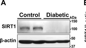 Anti-Sirt1(Sir2) Antibody Upstate&#174;, from rabbit