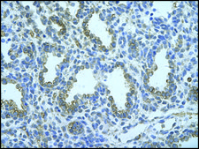Anti-FUS affinity isolated antibody