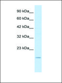 Anti-SNAI1 affinity isolated antibody