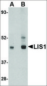 Anti-LIS1 antibody produced in rabbit affinity isolated antibody, buffered aqueous solution