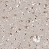 Anti-FHOD3 antibody produced in rabbit Prestige Antibodies&#174; Powered by Atlas Antibodies, affinity isolated antibody, buffered aqueous glycerol solution, Ab2