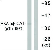 Anti-phospho-PKA &#945;/&#946; CAT (pThr197) antibody produced in rabbit affinity isolated antibody