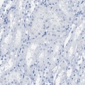 Anti-KCNA3 antibody produced in rabbit Prestige Antibodies&#174; Powered by Atlas Antibodies, affinity isolated antibody, buffered aqueous glycerol solution