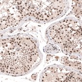 Anti-SETD2 antibody produced in rabbit Prestige Antibodies&#174; Powered by Atlas Antibodies, affinity isolated antibody, buffered aqueous glycerol solution
