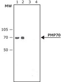Anti-PMP70 antibody produced in rabbit affinity isolated antibody, buffered aqueous solution