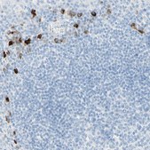 Anti-IL6ST antibody produced in rabbit Prestige Antibodies® Powered by Atlas Antibodies, affinity isolated antibody, buffered aqueous glycerol solution