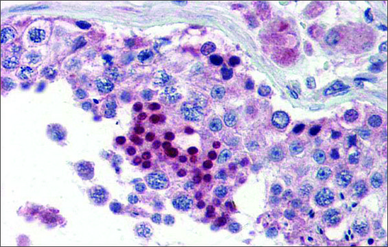 Anti-NR0B1 antibody produced in rabbit affinity isolated antibody