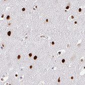 Monoclonal Anti-ADAR antibody produced in mouse Prestige Antibodies&#174; Powered by Atlas Antibodies, clone CL0176, purified immunoglobulin, buffered aqueous glycerol solution