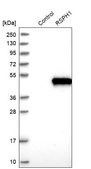 Anti-RSPH1 antibody produced in rabbit Prestige Antibodies&#174; Powered by Atlas Antibodies, affinity isolated antibody, buffered aqueous glycerol solution
