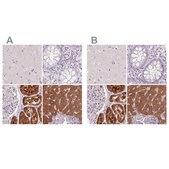 Anti-FTCD antibody produced in rabbit Prestige Antibodies&#174; Powered by Atlas Antibodies, affinity isolated antibody, buffered aqueous glycerol solution