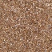 Anti-MPST antibody produced in rabbit Prestige Antibodies&#174; Powered by Atlas Antibodies, affinity isolated antibody, buffered aqueous glycerol solution
