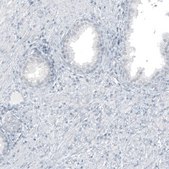 Monoclonal Anti-GLS2 antibody produced in mouse Prestige Antibodies&#174; Powered by Atlas Antibodies, clone CL7716, purified immunoglobulin, buffered aqueous glycerol solution