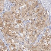 Anti-ARG1 antibody produced in rabbit Prestige Antibodies&#174; Powered by Atlas Antibodies, affinity isolated antibody, buffered aqueous glycerol solution