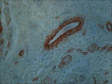 Monoclonal Anti-Collagen, Type IV antibody produced in mouse clone COL-94, ascites fluid