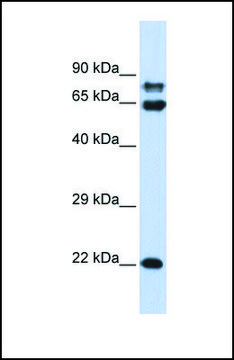 Anti-PPP2R1A, (N-terminal) antibody produced in rabbit affinity isolated antibody