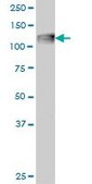 Monoclonal Anti-C3 antibody produced in mouse clone 5F9, purified immunoglobulin, buffered aqueous solution