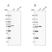 Anti-FTCD antibody produced in rabbit Prestige Antibodies&#174; Powered by Atlas Antibodies, affinity isolated antibody, buffered aqueous glycerol solution
