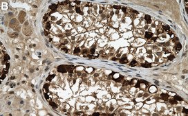 Anti-HSP90&#946; Antibody, clone 2E21 ZooMAb&#174; Rabbit Monoclonal recombinant, expressed in HEK 293 cells
