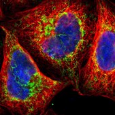 Anti-TOP1MT antibody produced in rabbit Prestige Antibodies&#174; Powered by Atlas Antibodies, affinity isolated antibody, buffered aqueous glycerol solution