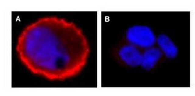 Anti-phospho-erbB-2/HER-2 (Tyr1248) Antibody Upstate&#174;, from rabbit
