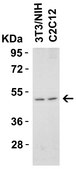 Anti-DR5 Antibody, CT Chemicon&#174;, from rabbit