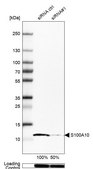 Anti-S100A10 antibody produced in rabbit Prestige Antibodies&#174; Powered by Atlas Antibodies, affinity isolated antibody, buffered aqueous glycerol solution