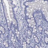 Anti-CALCA antibody produced in rabbit Prestige Antibodies&#174; Powered by Atlas Antibodies, affinity isolated antibody, buffered aqueous glycerol solution