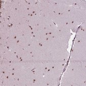 Anti-SIRT6 antibody produced in rabbit Prestige Antibodies&#174; Powered by Atlas Antibodies, affinity isolated antibody, buffered aqueous glycerol solution