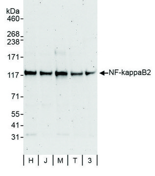Rabbit anti-NF-kappaB2 Antibody, Affinity Purified Powered by Bethyl Laboratories, Inc.