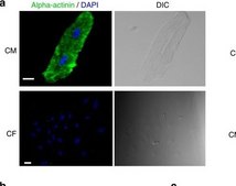 Monoclonal Anti-&#945;-Actinin antibody produced in mouse clone BM-75.2, ascites fluid