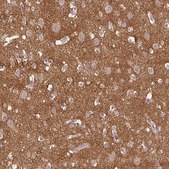 Anti-PRKAA2 antibody produced in rabbit Prestige Antibodies&#174; Powered by Atlas Antibodies, affinity isolated antibody, buffered aqueous glycerol solution