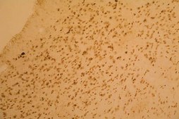 Anti-Synuclein &#945; Antibody, clone 7B12.2 culture supernatant, clone 7B12.2, Chemicon&#174;