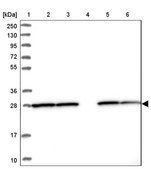 Anti-PGAM1 antibody produced in rabbit Prestige Antibodies&#174; Powered by Atlas Antibodies, affinity isolated antibody, buffered aqueous glycerol solution