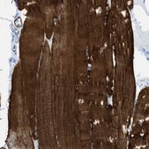 Anti-DES antibody produced in rabbit Prestige Antibodies&#174; Powered by Atlas Antibodies, affinity isolated antibody, buffered aqueous glycerol solution