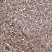 Anti-GPT antibody produced in rabbit Prestige Antibodies&#174; Powered by Atlas Antibodies, affinity isolated antibody, buffered aqueous glycerol solution, ab1