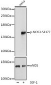 Anti-Phospho-eNOS-S1177 antibody produced in rabbit
