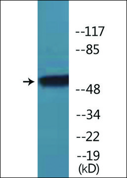 Anti-phospho-TR-&#946;1 (pSer142) antibody produced in rabbit affinity isolated antibody