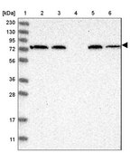 Anti-AFP antibody produced in rabbit Prestige Antibodies® Powered by Atlas Antibodies, affinity isolated antibody, buffered aqueous glycerol solution
