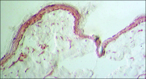 Monoclonal Anti-Collagen, Type III antibody produced in mouse clone FH-7A, ascites fluid