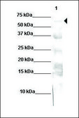 Anti-NR4A2 (AB2) antibody produced in rabbit affinity isolated antibody
