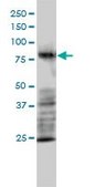 Monoclonal Anti-MRE11A antibody produced in mouse clone 1D8-A6, purified immunoglobulin, buffered aqueous solution