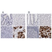 Anti-CA6 antibody produced in rabbit Prestige Antibodies® Powered by Atlas Antibodies, affinity isolated antibody, buffered aqueous glycerol solution, ab1