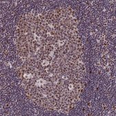 Anti-DIS3 antibody produced in rabbit affinity isolated antibody, buffered aqueous glycerol solution