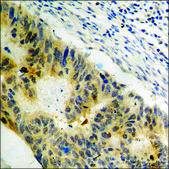 Anti-phospho-FKHR (pSer319) antibody produced in rabbit affinity isolated antibody