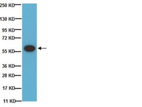 Anti-Tyrosine Hydroxylase Antibody, phosphoSer 40 Chemicon&#174;, from rabbit