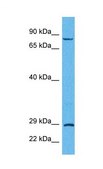 Anti-TRIM32 antibody produced in rabbit affinity isolated antibody