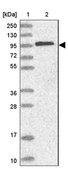Anti-CTNNA1 antibody produced in rabbit Prestige Antibodies&#174; Powered by Atlas Antibodies, affinity isolated antibody, buffered aqueous glycerol solution