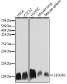 Anti-S100A6 Antibody, clone 0J1Q5, Rabbit Monoclonal