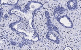 Anti-RAR-alpha Antibody, clone 3L14, ZooMAb&#174; Rabbit Monoclonal recombinant, expressed in HEK 293 cells