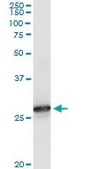 Monoclonal Anti-PRDX6 antibody produced in mouse clone 3A10-2A11, purified immunoglobulin, buffered aqueous solution
